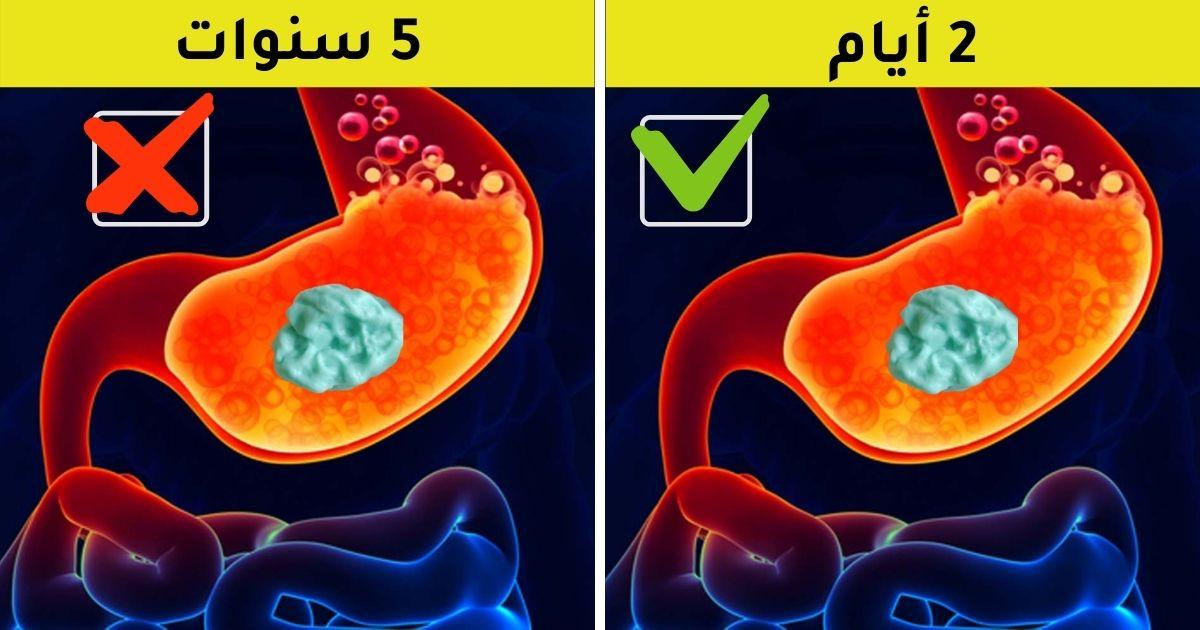 ابتلاع العلكة