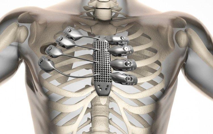 human radiography scan with bones