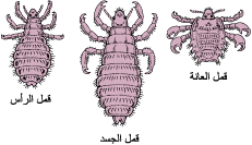 louse-kinds