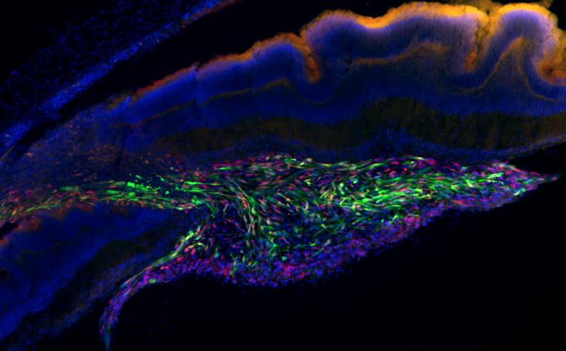 eye-retina-stemm-cells الرؤية في العين